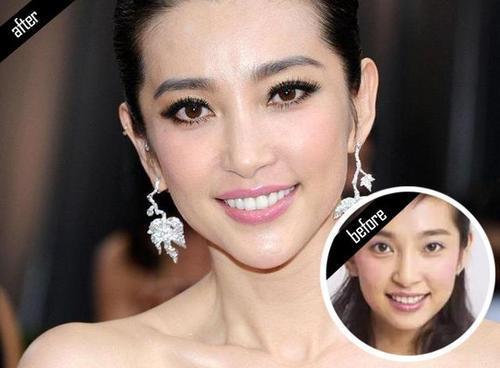 牙黄男明星,揭秘那些独具特色的牙黄男明星风采